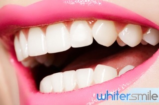 Visit Melbourne: At-Home Teeth Whitening Kit, Delivered